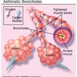 Natural Bronchial Dilator - Bronchitis Duration