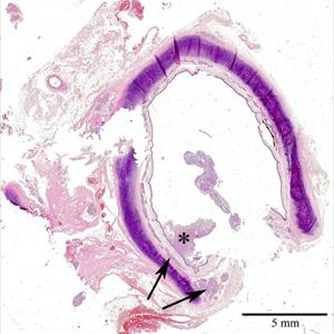 Getting Rid Of Hoarseness - Exercise Benefits To Beat Dyspnoea For COPD Sufferers