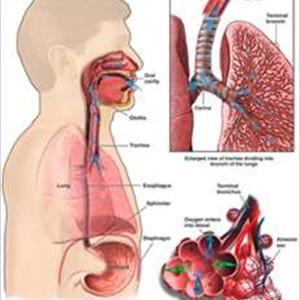 Stop Wheezing Naurally - Smoking Can Cause Bronchitis? Study This!